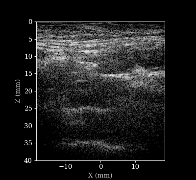 B-mode sequence