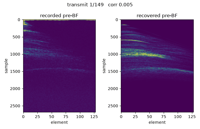 carotid pre-beamformed channel data: recorded vs recovered