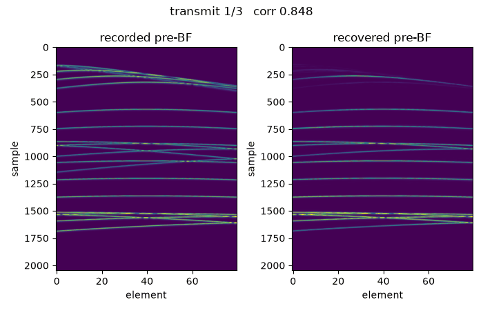 CIRS pre-beamformed channel data: recorded vs recovered