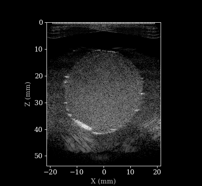 Doppler B-mode Animation