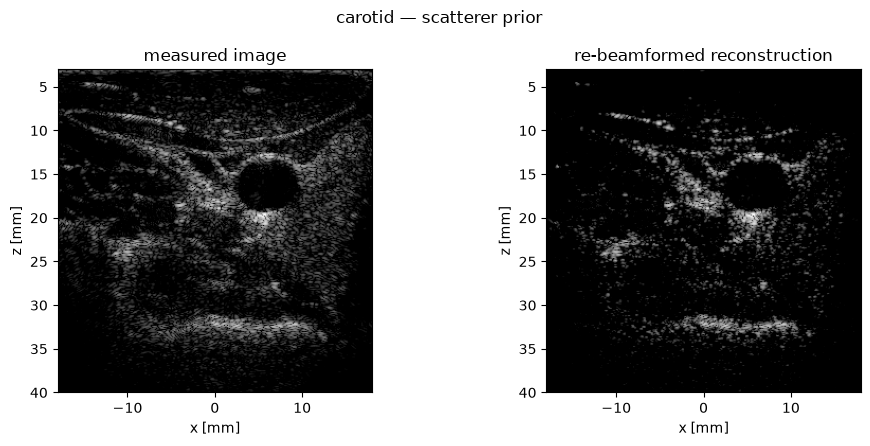 ../../_images/notebooks_inverse_carotid_example_14_0.png