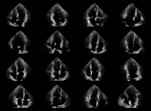 ../../_images/notebooks_models_diffusion_model_example_14_0.png