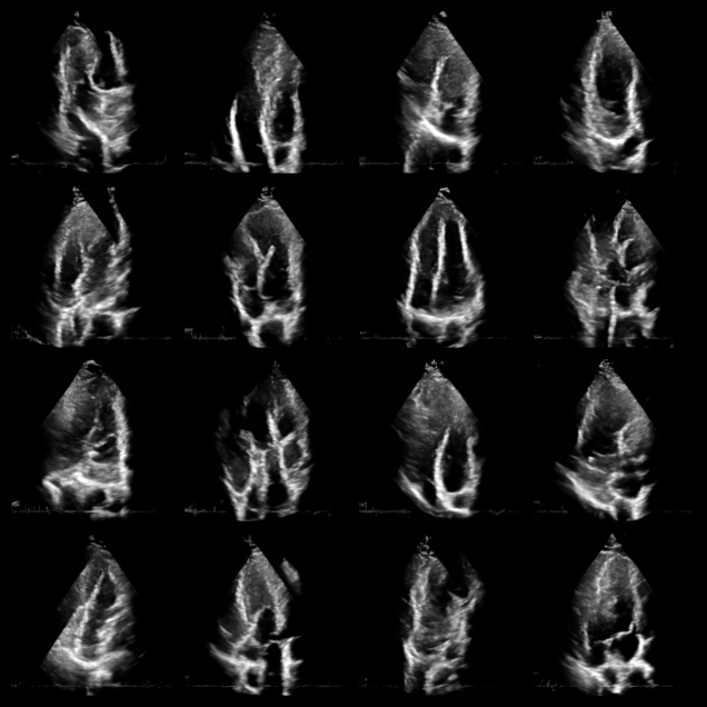 ../../_images/notebooks_models_nuclear_dehazing_example_14_0.png