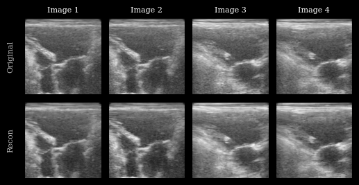 ../../_images/notebooks_models_taesd_autoencoder_example_15_0.png
